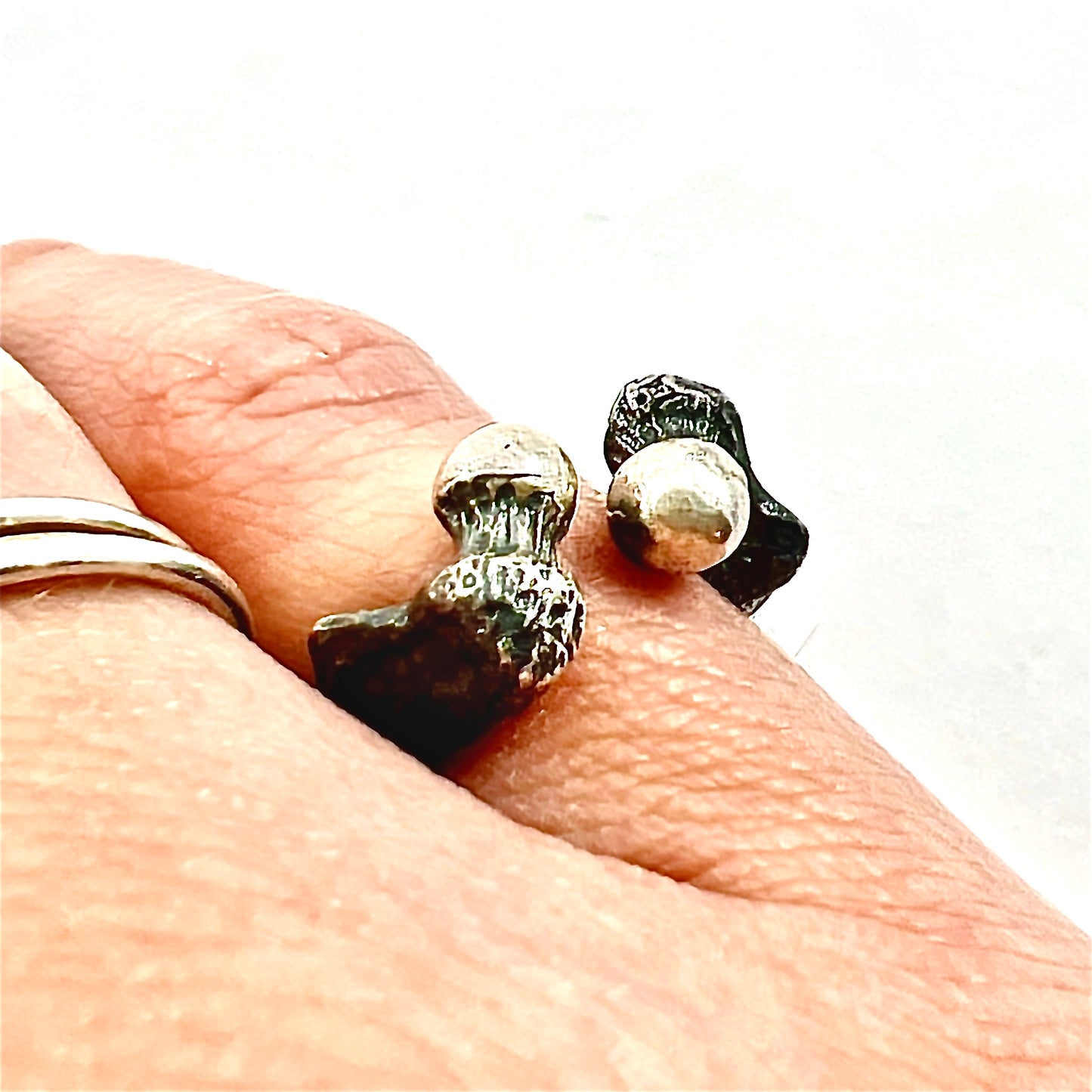 Femur Ring